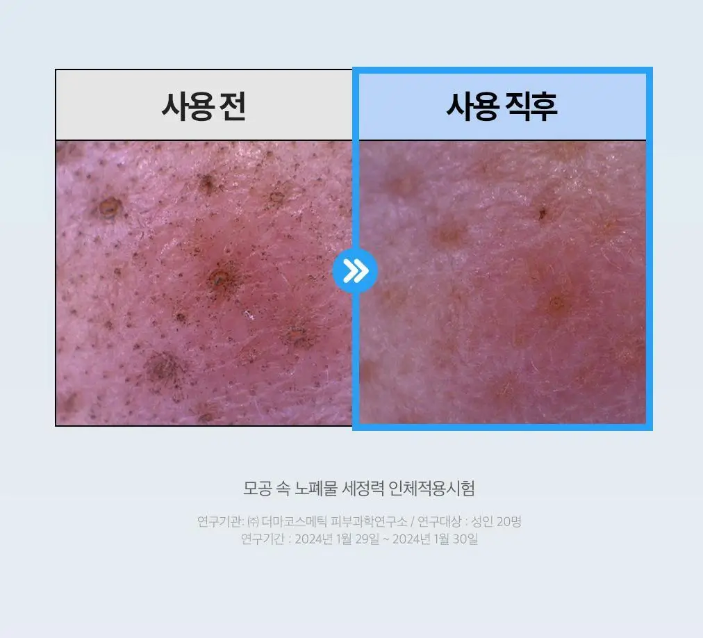[블랙화이트헤드세정] 듀이트리 하이 아미노 올 모공 딥 클렌징밤 90g 상세페이지 19